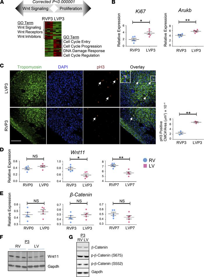 Chamber-specific enrichment of cellular proliferation and Wnt signaling ...