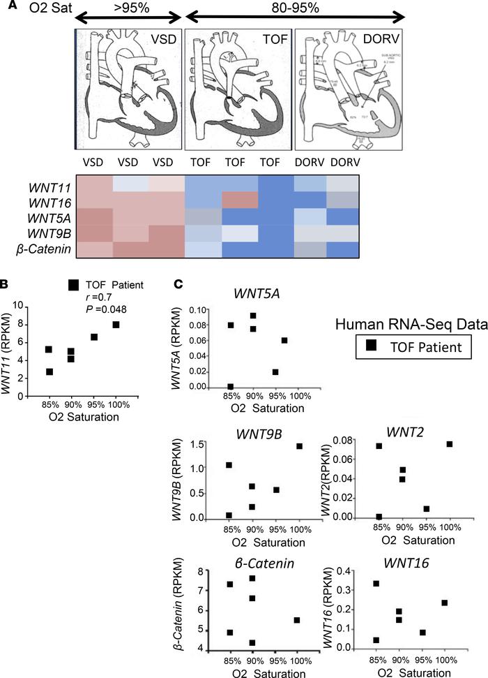 Wnt11 may play important roles in human congenital heart defects (CHDs)....