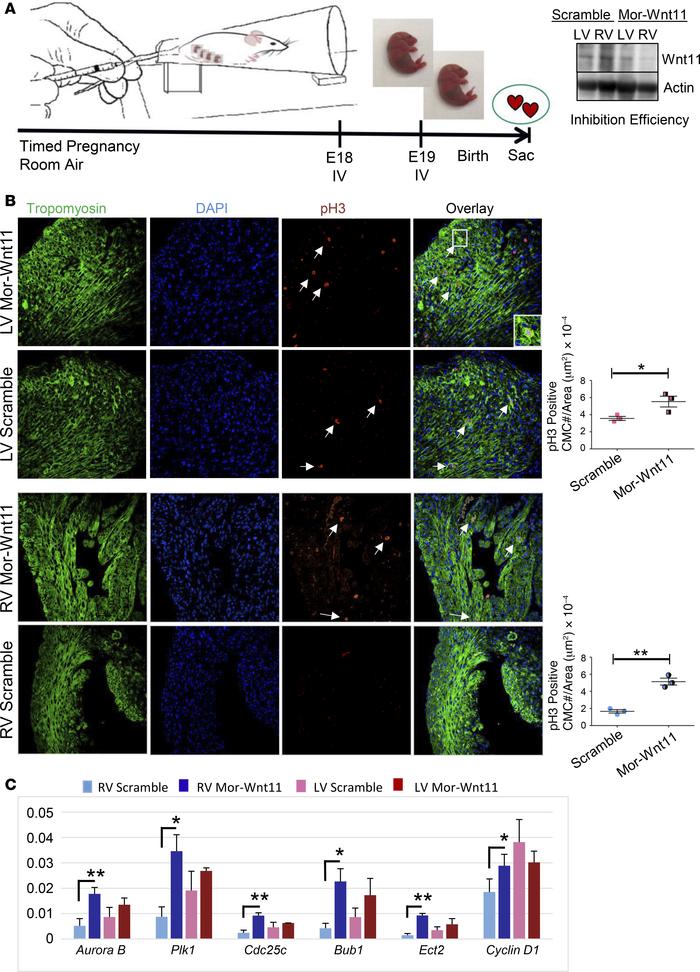 Systemic Wnt11 inhibition induces cardiomyocyte proliferation in a chamb...