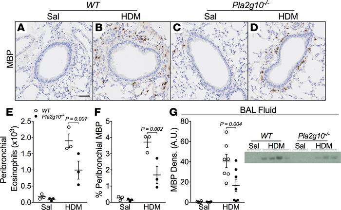 Peribronchiolar eosinophilic inflammation is decreased in mice lacking P...