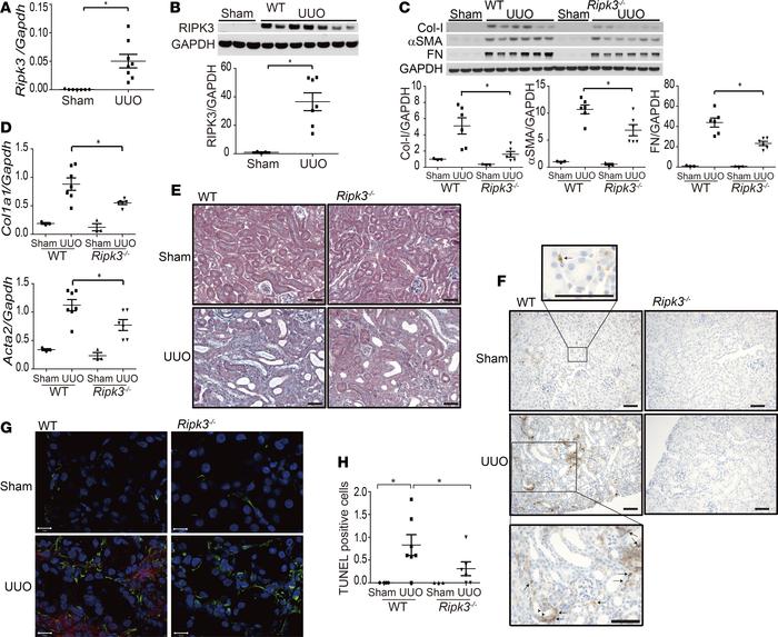 RIPK3 promotes kidney fibrosis in the UUO model.
WT (A–H) or Ripk3–/– mi...