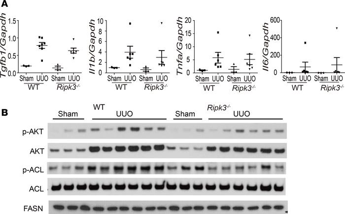 RIPK3 regulates AKT and ACL.
WT and Ripk3–/– mice were subjected to UUO ...