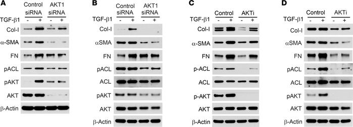 Inhibition of AKT suppresses TGF-β1–induced ECM production in fibroblast...