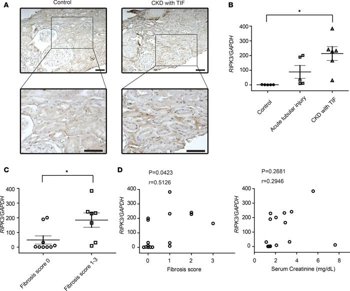 RIPK3 expression in human kidney disease.
(A) Representative immunohisto...