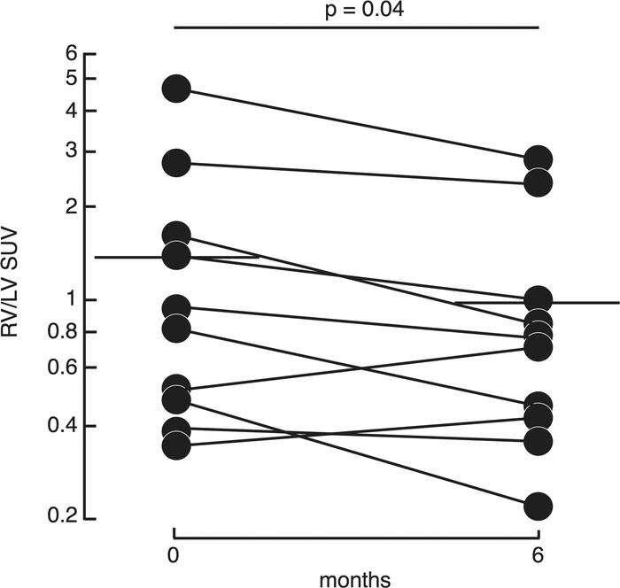 Right ventricle (RV) uptake of 2-[18F]fluoro-2-deoxy-D-glucose (FDG) rel...