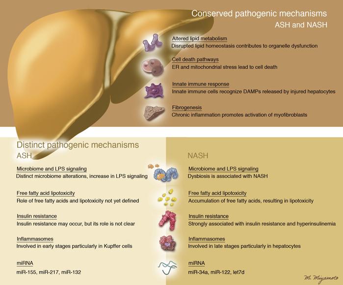 Overview of pathogenic similarities and differences between ASH and NASH...