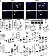 Swiprosin-1 deficiency restrains macrophage recruitment and attenuates proi