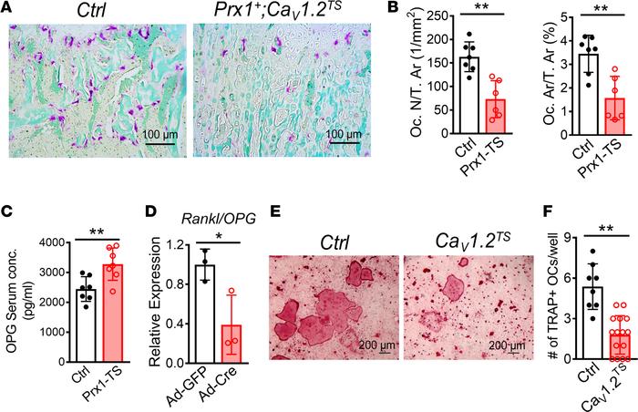 CaV1.2TS channel decreases osteoclast differentiation.
(A) Representativ...