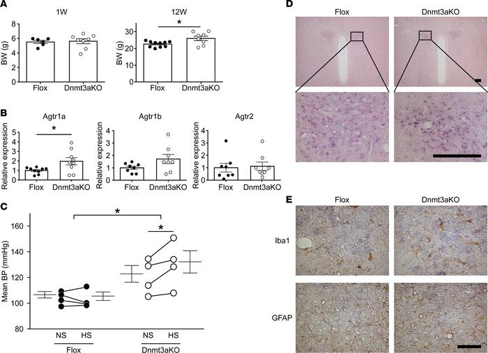 Salt-sensitive hypertension in offspring of hypothalamic neuron–specific...