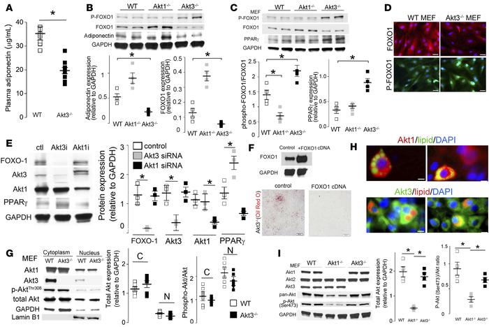 Akt3 regulates adipogenesis via a FOXO1 pathway.
(A) Plasma adiponectin ...