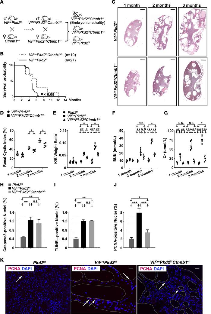 
Ctnnb1 allelic reduction ameliorates ADPKD phenotypes in VilCrePkd2f/f ...