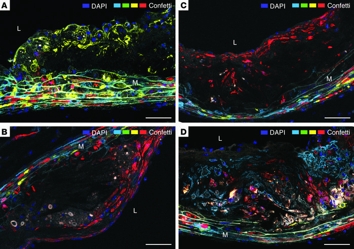 Plaque SMCs are organized in large clonal patches.
(A–D) Four examples a...