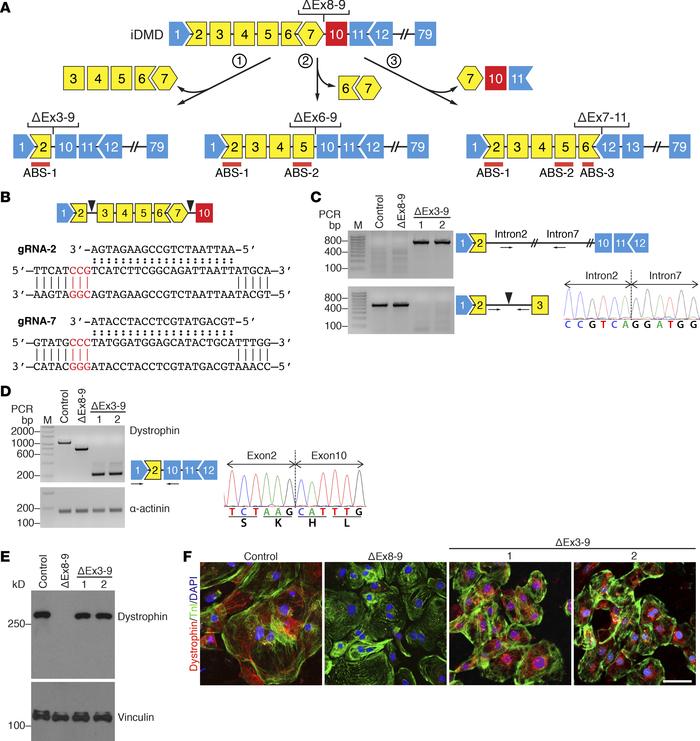 Correcting ΔEx8-9 iDMD by exon deletion to restore dystrophin expression...