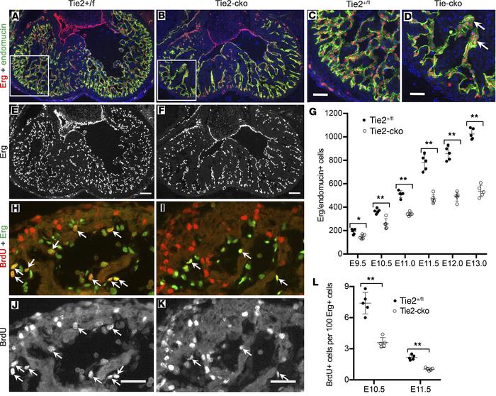 Endocardial attenuation of Tie2 results in decreased EC number and proli...
