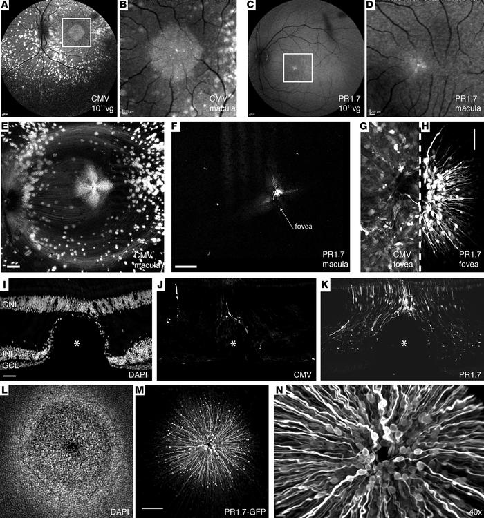 Foveal cone transduction with PR1.7 promoter versus cytomegalovirus (CMV...