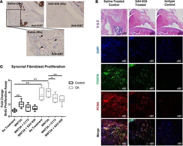 Proliferation of synovial fibroblasts is elevated in OA and can be moder...