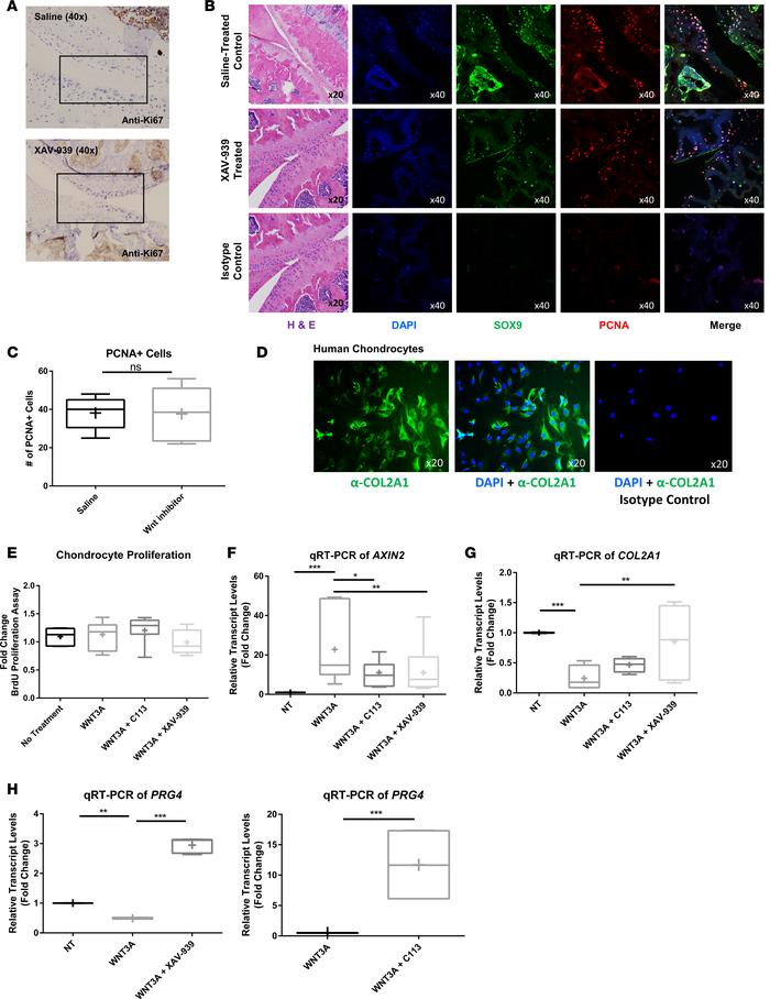 Wnt inhibitor treatment of chondrocytes does not alter proliferation but...