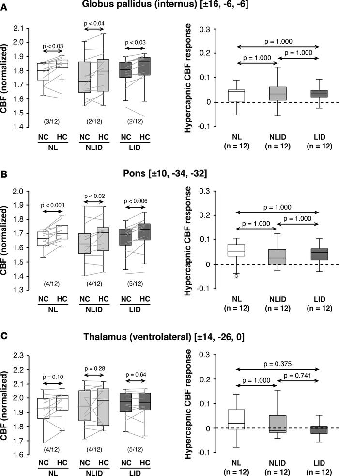 Hypercapnic cerebral blood flow responses in other levodopa dissociation...