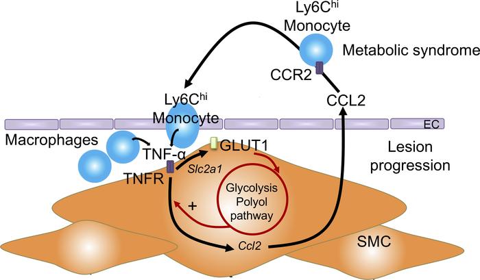 Mechanistic model.
The metabolic syndrome phenotype results in monocytos...