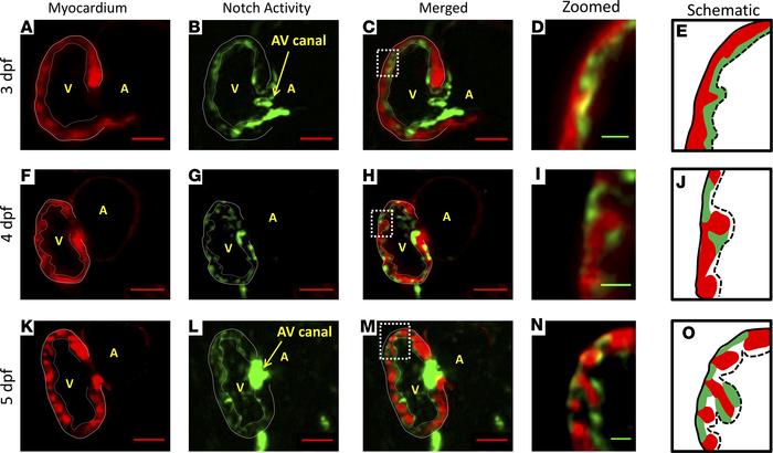 NICD mRNA injection rescued Notch activation and trabeculation in the DA...