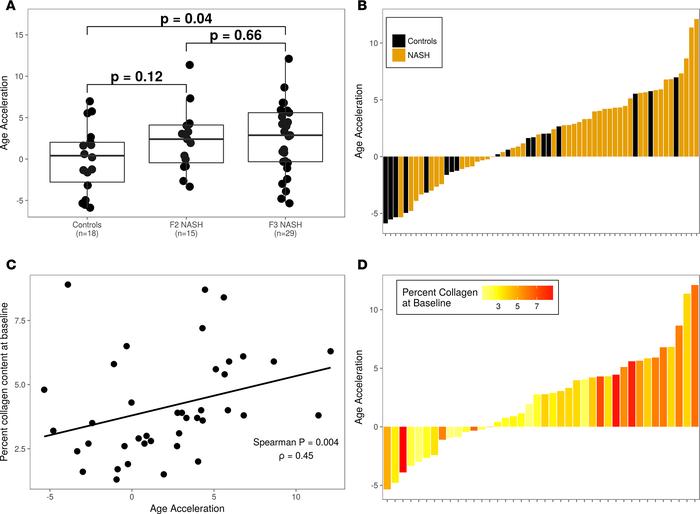 Age acceleration is associated with liver fibrosis and collagen content....