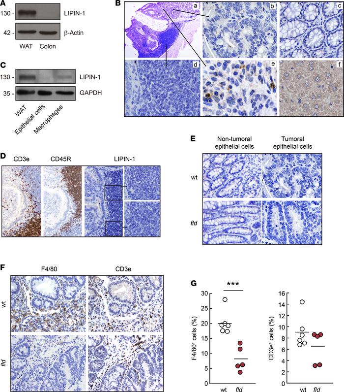 Lipin-1 is expressed in tumor macrophages.
(A) Homogenates from white ad...