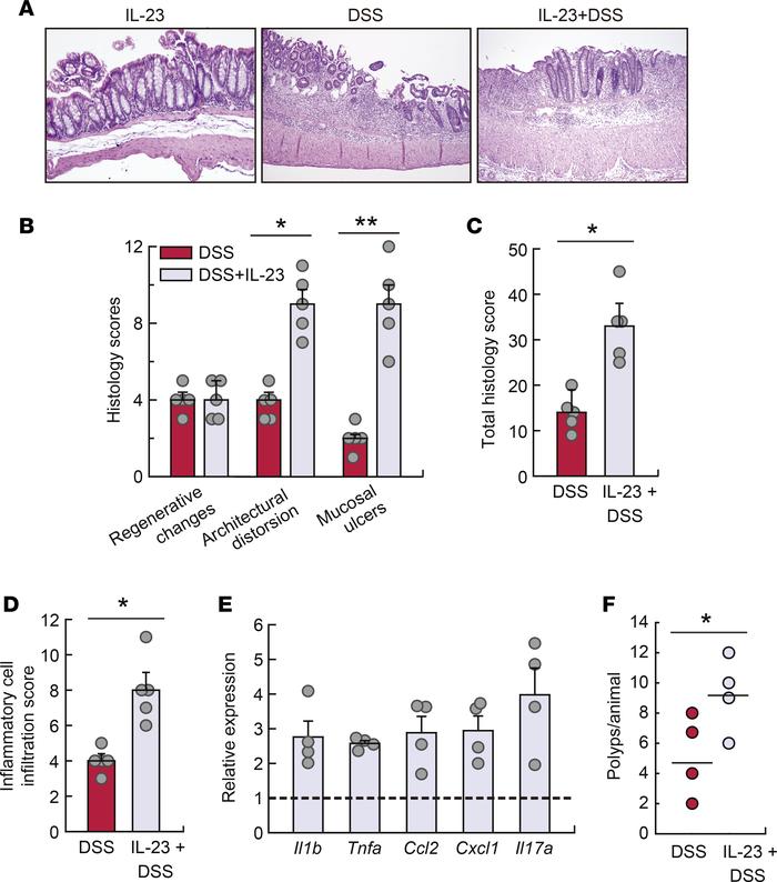 IL-23 increases susceptibility to DSS-induced inflammation in lipin-1–de...