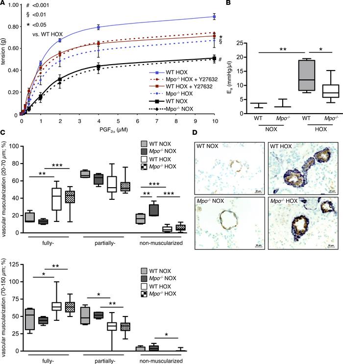 Pulmonary vascular constriction.
Hypoxia-induced pulmonary vascular cons...