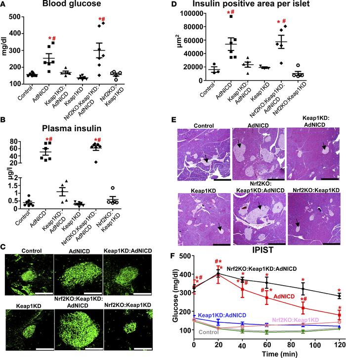 Nrf2 pathway activation protects AdNICD mice from insulin resistance.
(A...