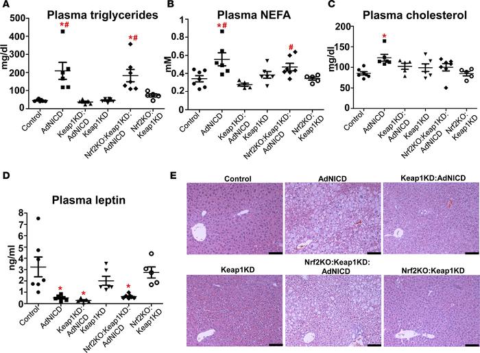Nrf2 prevents AdNICD mice from dyslipidemia and fatty liver disease.
(A)...