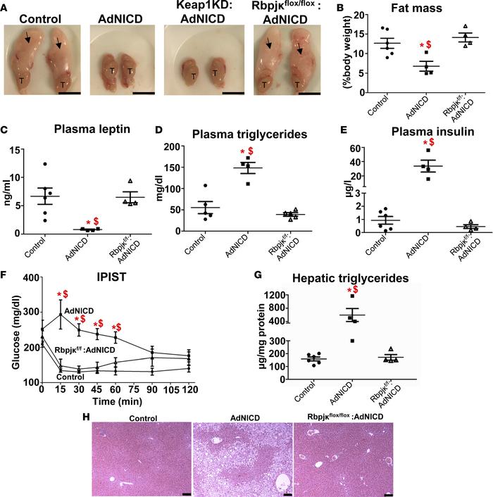 Adipocyte-specific Rbpjκ deletion in AdNICD mice restores adipose tissue...
