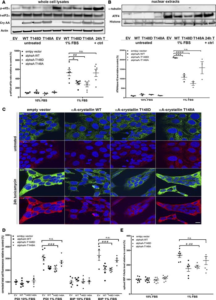 αA-crystallin attenuates endoplasmic reticulum stress in retinal neurons...