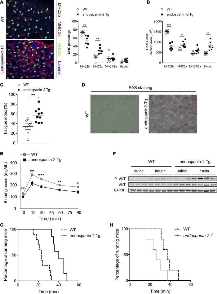 Endospanin-2 regulates skeletal muscle plasticity and endurance capacity...