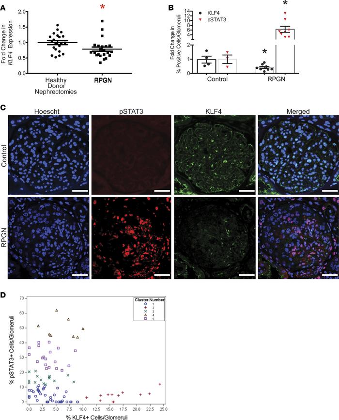 Reduced KLF4 expression and increased phospho-STAT3 expression in human ...