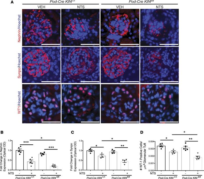 
Podocin-Cre Klf4fl/fl mice exhibit significant podocyte injury after NT...