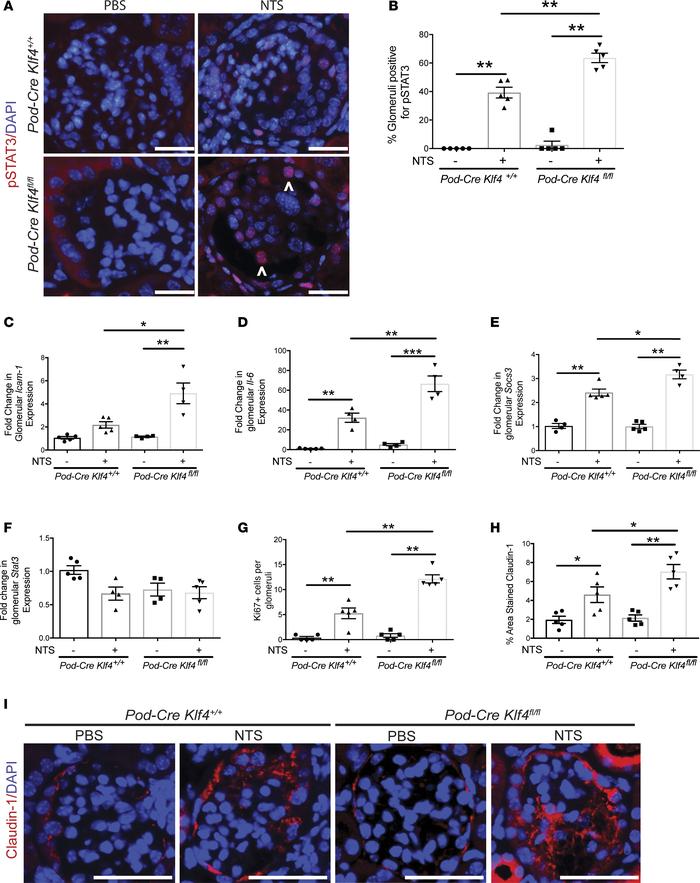 
Podocin-Cre Klf4fl/fl mice exhibit increased STAT3 activation and parie...