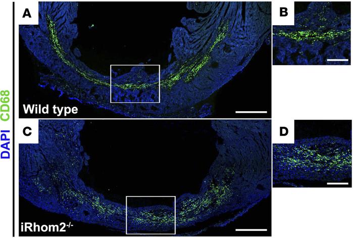 Localization of CD68+ immune cells within the infarct region of iRhom2-d...