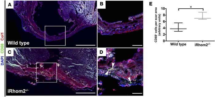 Presence of immune cells within the scar of iRhom2-deficient hearts at 2...