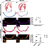 Collagen fiber deposition in the infarct region of iRhom2-deficient hearts