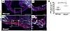 Presence of immune cells within the scar of iRhom2-deficient hearts at 28 d