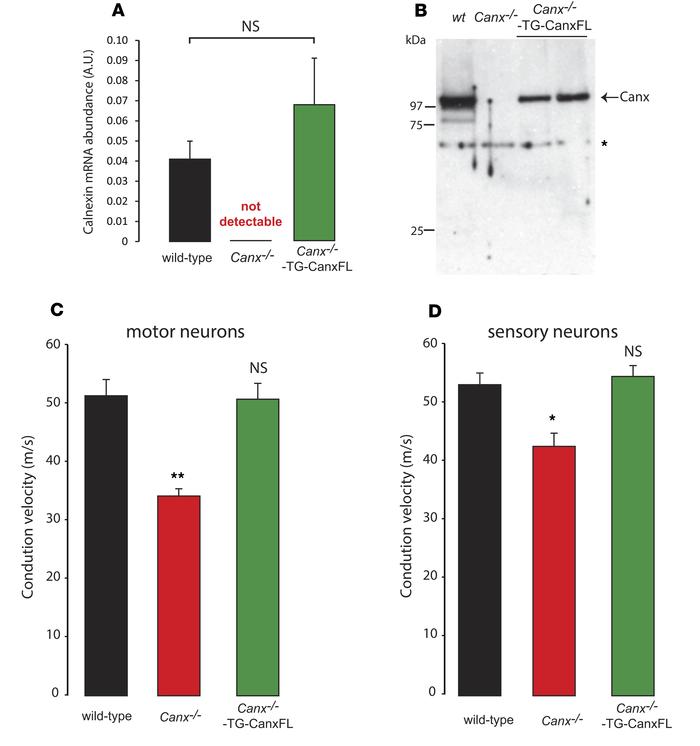 Transgenic Canx–/– mice expressing full-length calnexin protein.
(A) Abu...