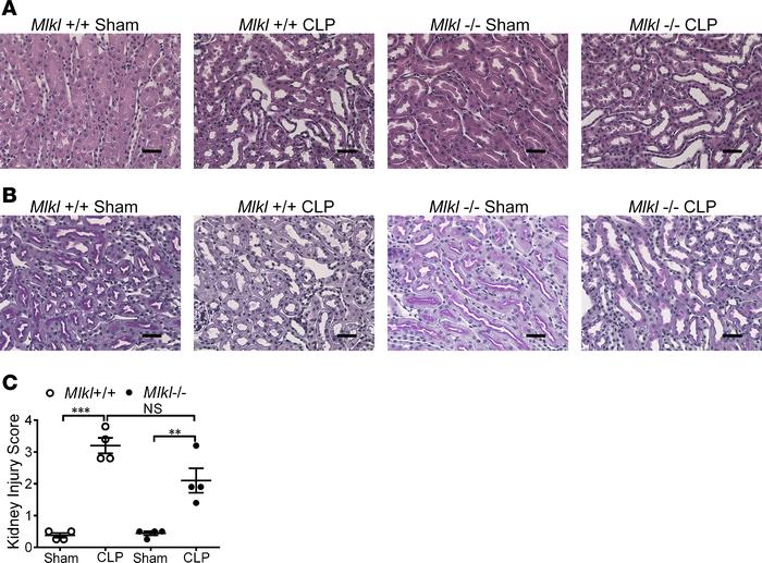 
Mlkl deficiency does not protect against kidney tubular injury in sepsi...