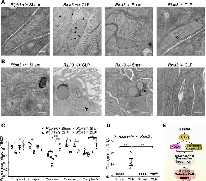 
Ripk3 deficiency reduces mitochondrial dysfunction in vivo.
(A) Represe...