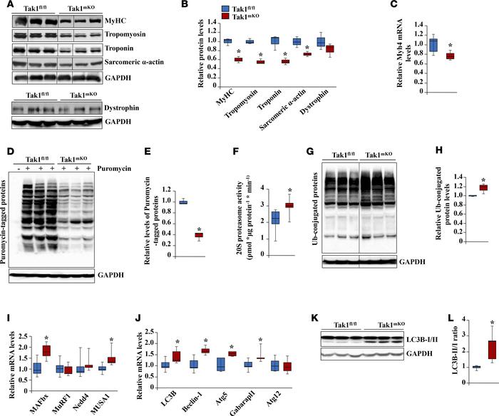 Inactivation of TAK1 perturbs the rate of protein synthesis and protein ...