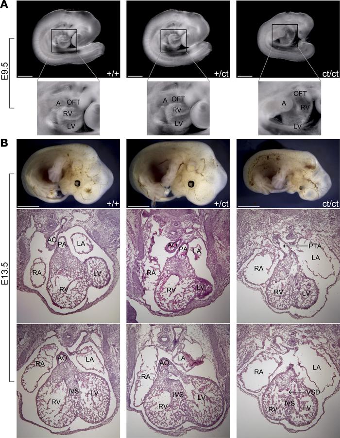 
Hnrnpa1ct/ct mutant mice display severe congenital cardiac malformation...