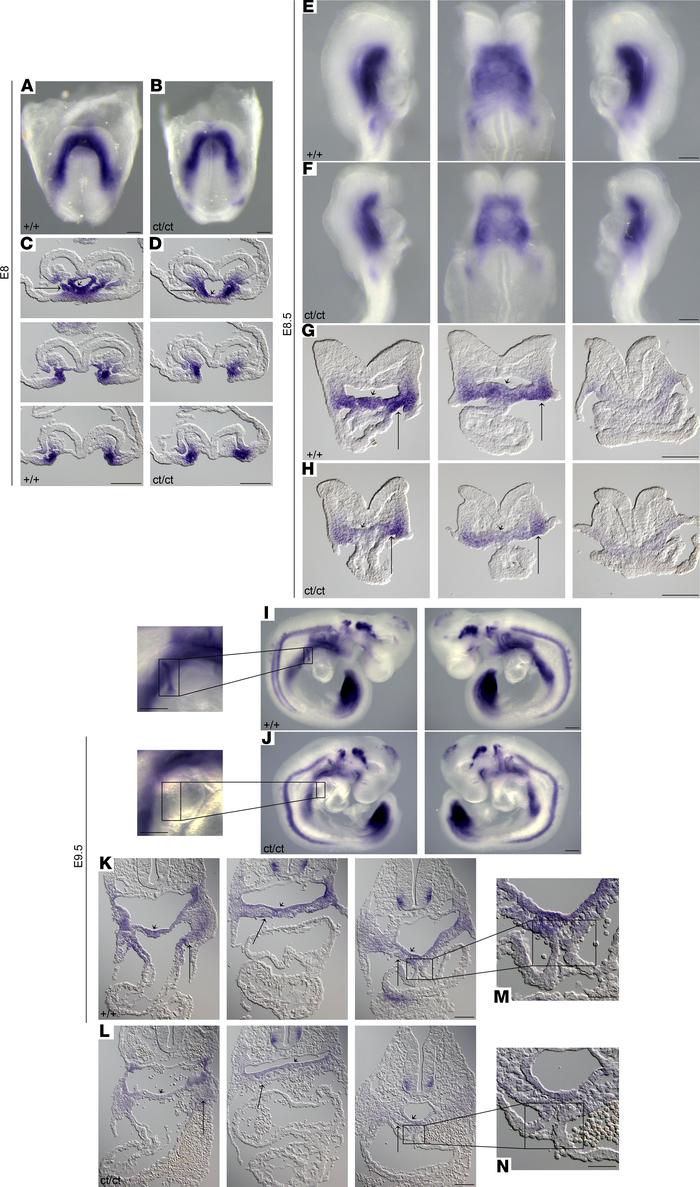 Altered expression pattern of Isl1 shows SHF-related defects in Hnrnpa1c...