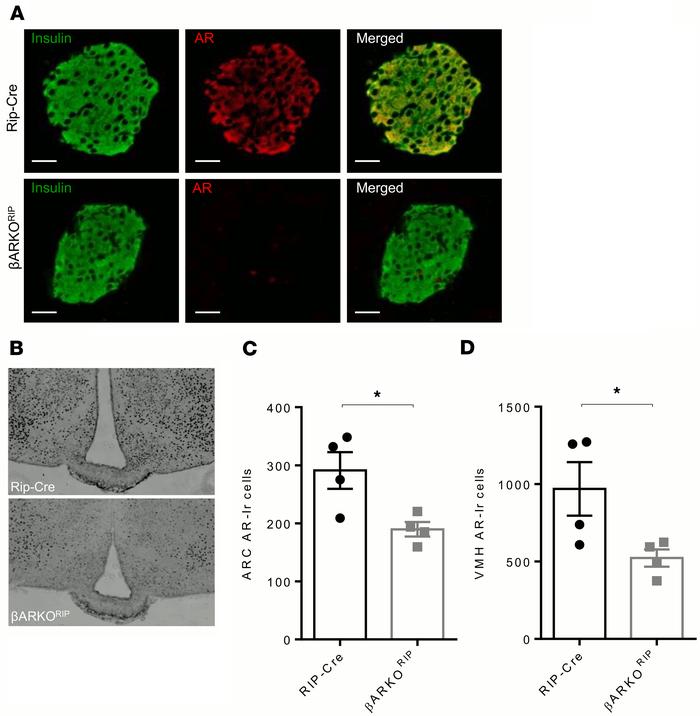 AR expression in pancreatic β cells and the hypothalamus of βARKORIP fem...