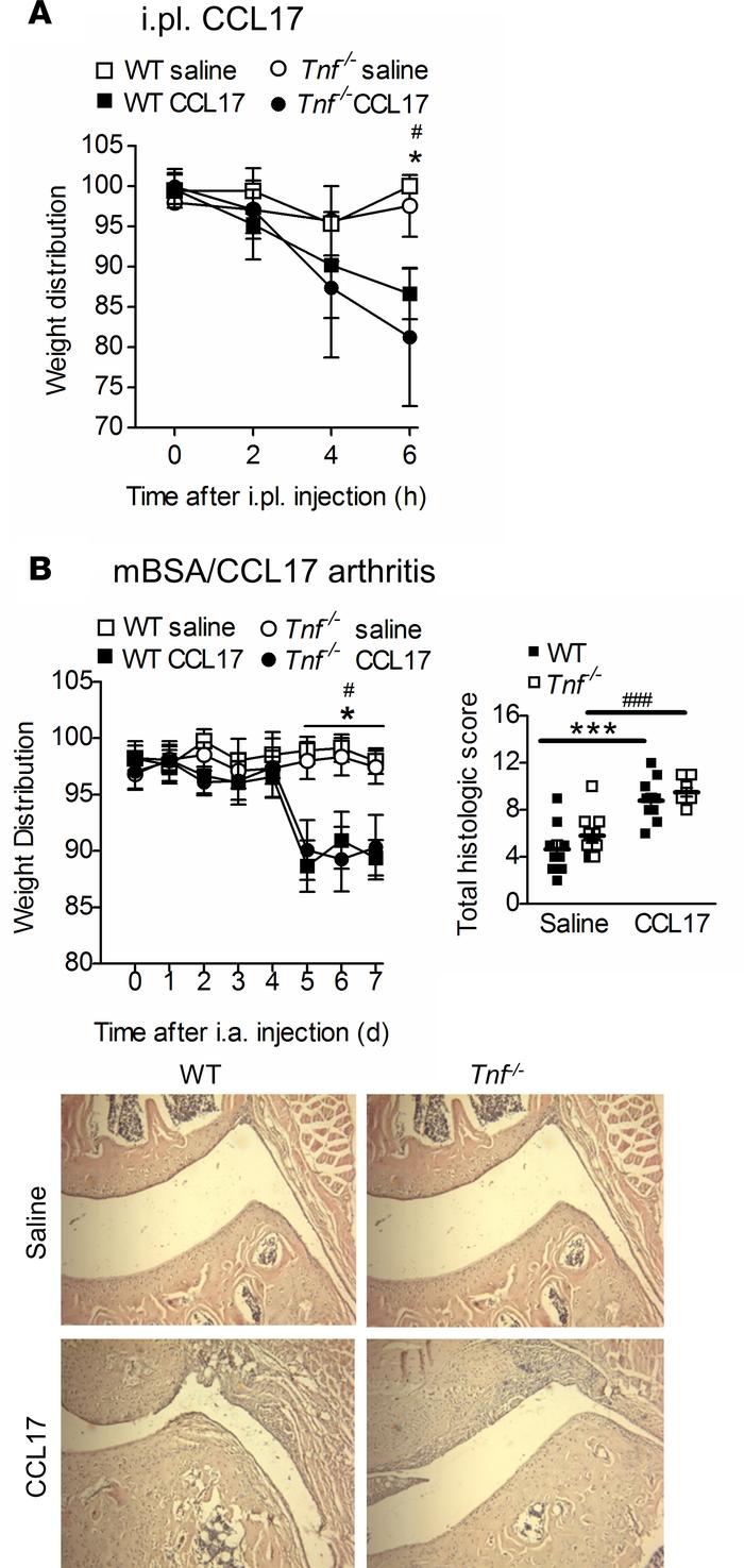 TNF is not required for CCL17-driven inflammatory pain and CCL17-driven ...