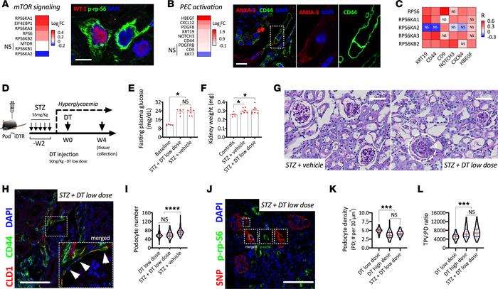 mTOR-mediated podocyte hypertrophy in diabetic mice and humans.
(A) Tran...