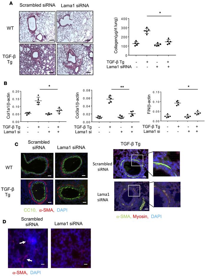 Lama1 plays an essential role in TGF-β–stimulated pulmonary fibrosis.
Lu...